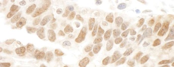 Rabbit anti-Abraxas Antibody