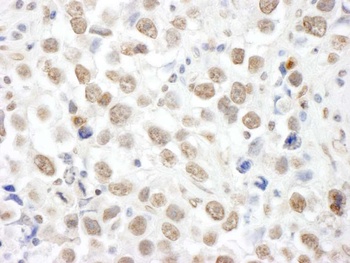 Rabbit anti-TOPORS Antibody