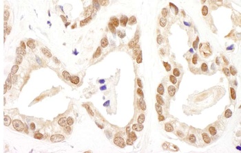Rabbit anti-FANCD2 Antibody