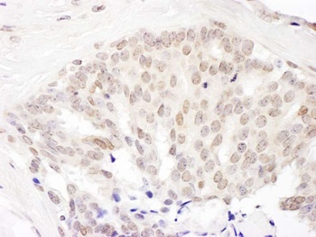 Rabbit anti-Cul5 Antibody