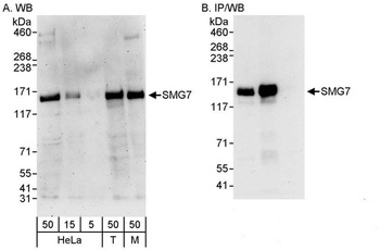 Rabbit SMG7 Antibody