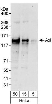 Rabbit AXL Antibody