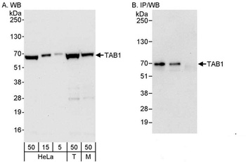 Rabbit TAB1 Antibody