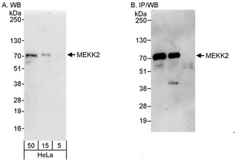 Rabbit MEKK2 Antibody