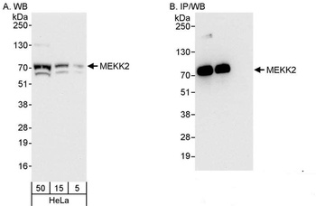 Rabbit MEKK2 Antibody