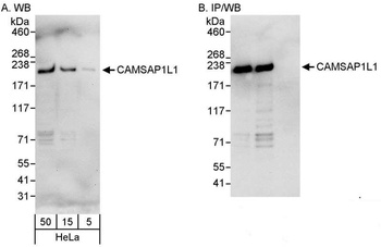 Rabbit CAMSAP1L1 Antibody