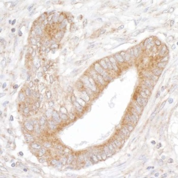 Rabbit anti-IP3R3 Antibody