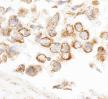 Rabbit anti-CNOT3 Antibody
