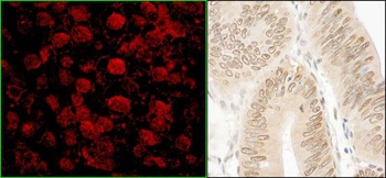 Rabbit NARG1 Antibody
