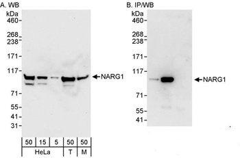 Rabbit NARG1 Antibody