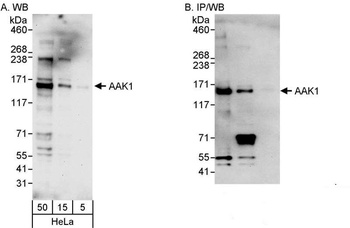 Rabbit AAK1 Antibody