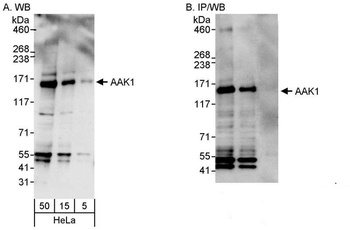 Rabbit AAK1 Antibody