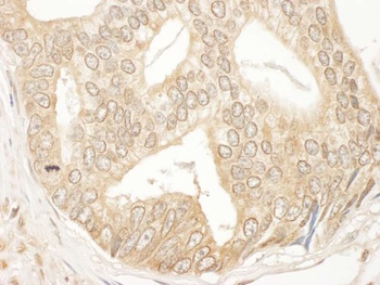 Rabbit MEK2 Antibody