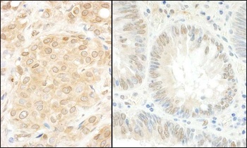 Rabbit MEK1 Antibody