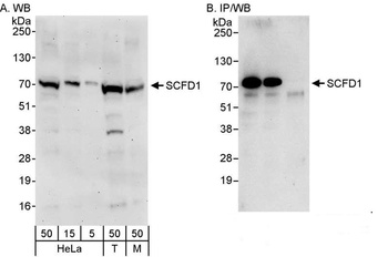 Rabbit SCFD1 Antibody