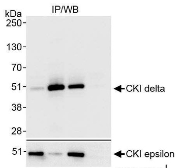 CKI delta Antibody