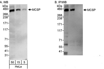 Rabbit MCSP Antibody