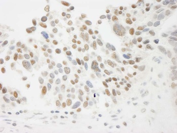 Rabbit anti-THOC5 Antibody