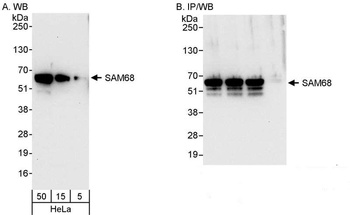 Rabbit SAM68 Antibody