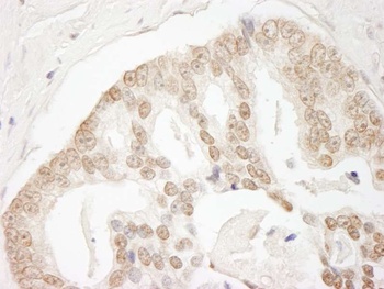 Rabbit anti-GIT2 Antibody