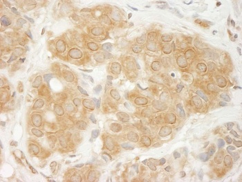 Rabbit anti-GIT1 Antibody