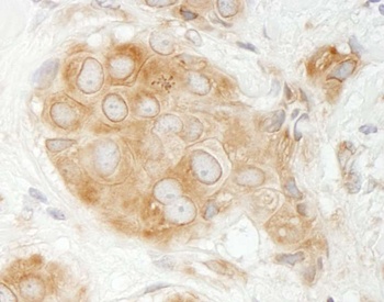 Rabbit anti-GIT1 Antibody