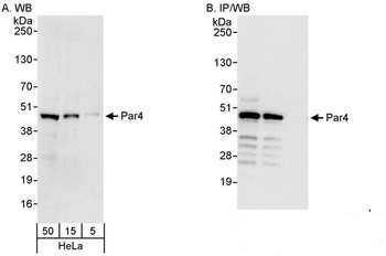 Rabbit anti-Par4 Antibody
