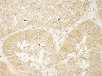 Rabbit anti-LARP1 Antibody