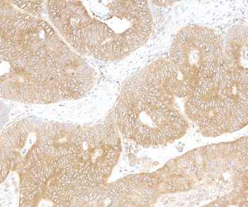 Rabbit anti-LARP1 Antibody