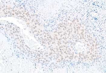Rabbit U2AF35 Antibody
