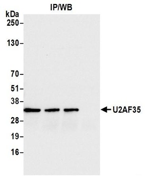 U2AF35 Antibody