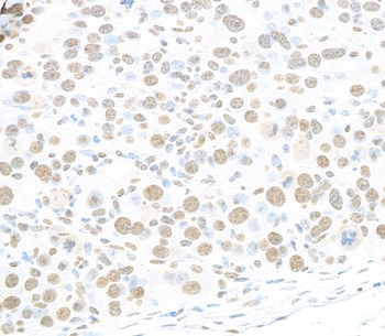 Rabbit anti-RALY Antibody
