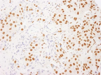 Rabbit anti-RALY Antibody