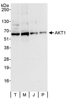 Rabbit anti-AKT1 Antibody