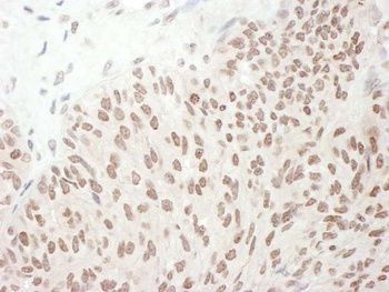 RelA, Phospho (S468) Antibody