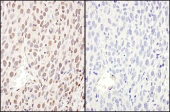 RelA, Phospho (S468) Antibody
