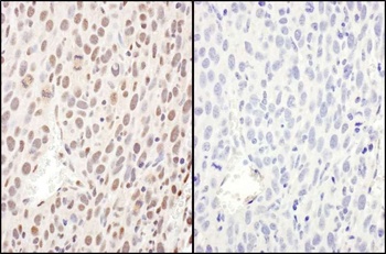 Rabbit anti-Phospho RelA (S468) Antibody