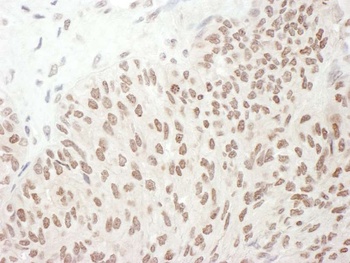 Rabbit anti-Phospho RelA (S468) Antibody