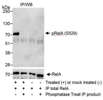 Rabbit anti-Phospho RelA (S529) Antibody