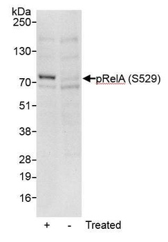 Rabbit anti-Phospho RelA (S529) Antibody