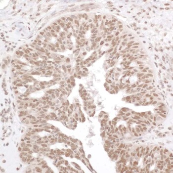 Rabbit anti-Phospho RelA (S536) Antibody