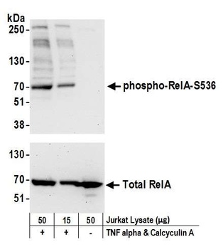 Rabbit anti-Phospho RelA (S536) Antibody