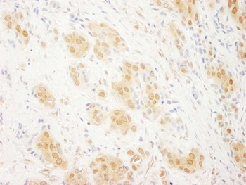 Rabbit ERK2 Antibody
