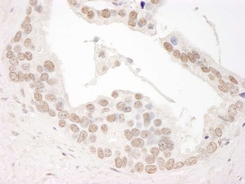 Cyclin L1 Antibody