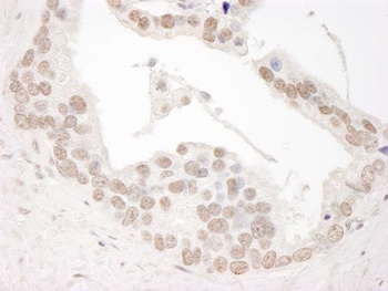 Rabbit anti-Cyclin L1 Antibody