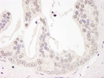 Rabbit anti-Cyclin L1 Antibody