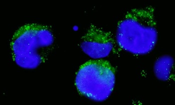Rabbit anti-BCR Antibody
