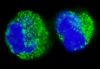 Rabbit BCR Antibody
