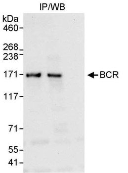 Rabbit BCR Antibody