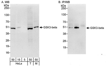 Rabbit GSK3-beta Antibody